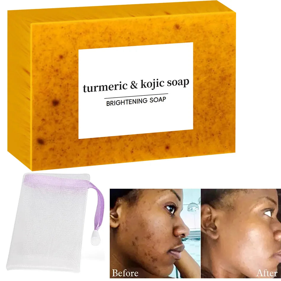 Turmeric Kojic Acid Glow Soap