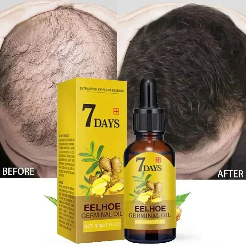 Ginger Hair Growth Serum