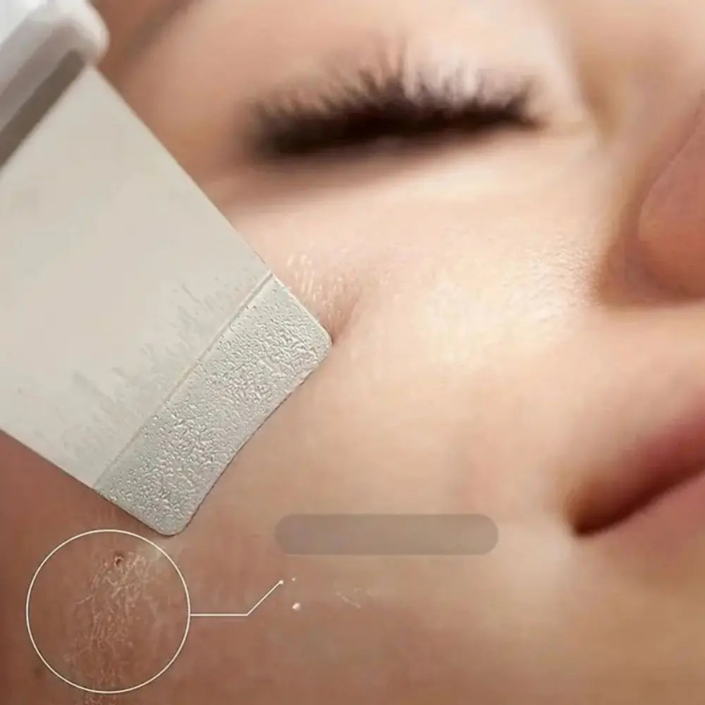 Ultrasonic Skin Scraper Pore Cleaning